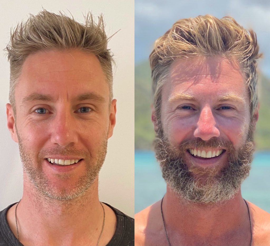 Before and after rowing the Atlantic